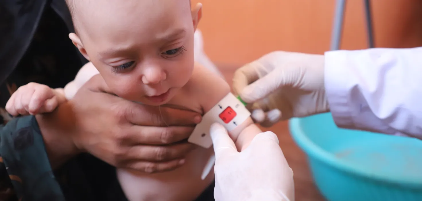 Unterernährtes Kind in Afghanistan wird in mobiler World-Vision-Klinik behandelt