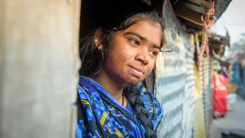 Mädchen aus Bangladesch mit Narben durch Verbrennungen, die während ihrer Arbeit entstanden.