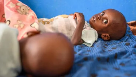 Unterernährung Sudankrise