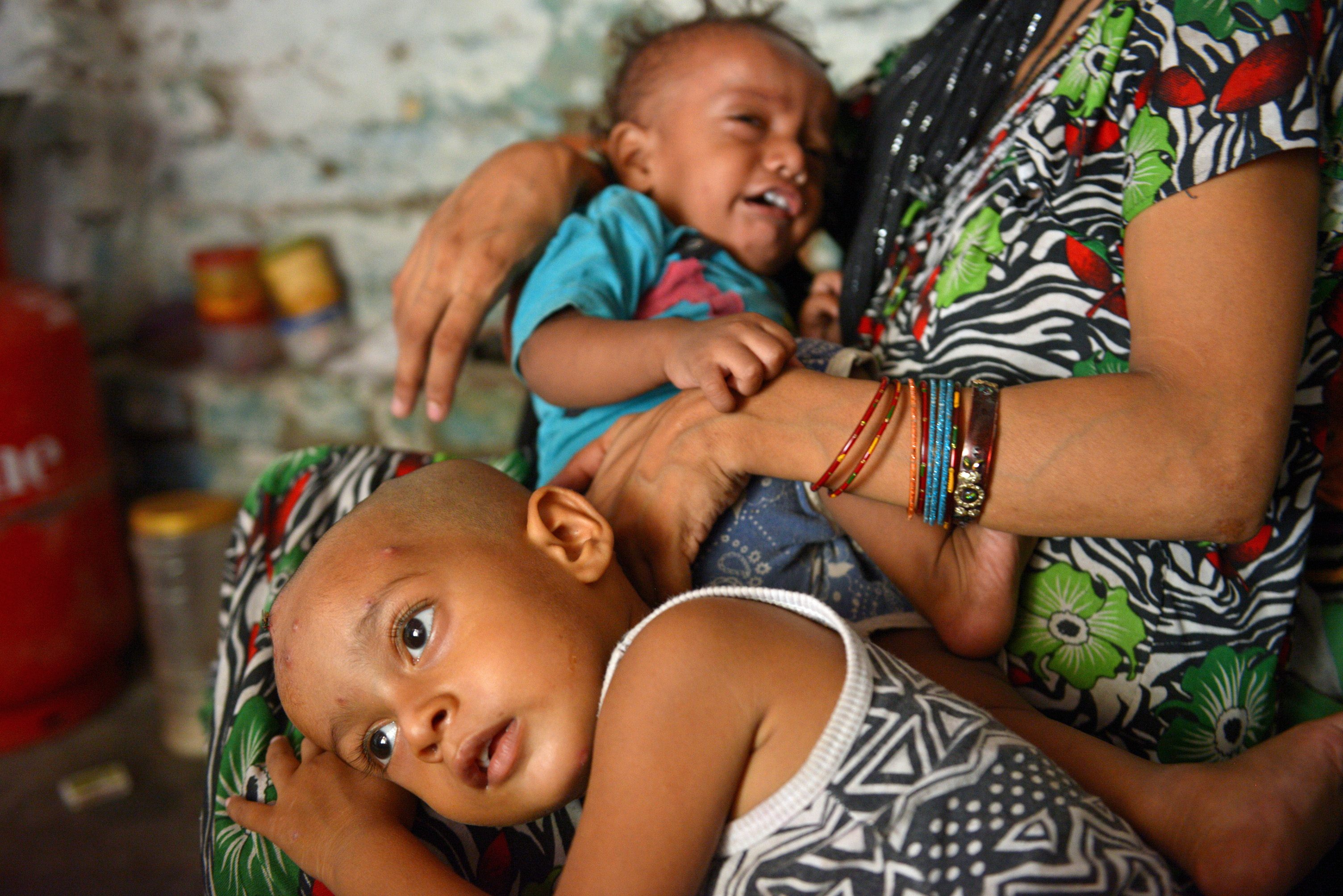 im G20-Land Indien sterben jährlich 1,2 Mio. Kinder vor dem 5. Lebensjahr
