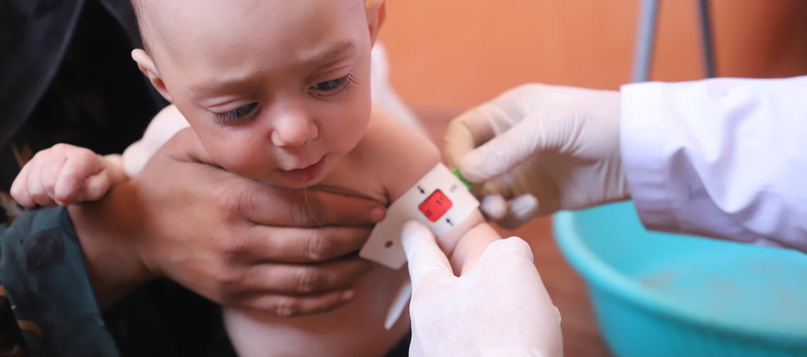 Unterernährtes Kind in Afghanistan wird in mobiler World-Vision-Klinik behandelt