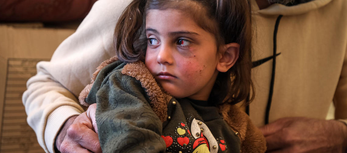 syrisches Kind mit Verletzungen nach Erdbeben