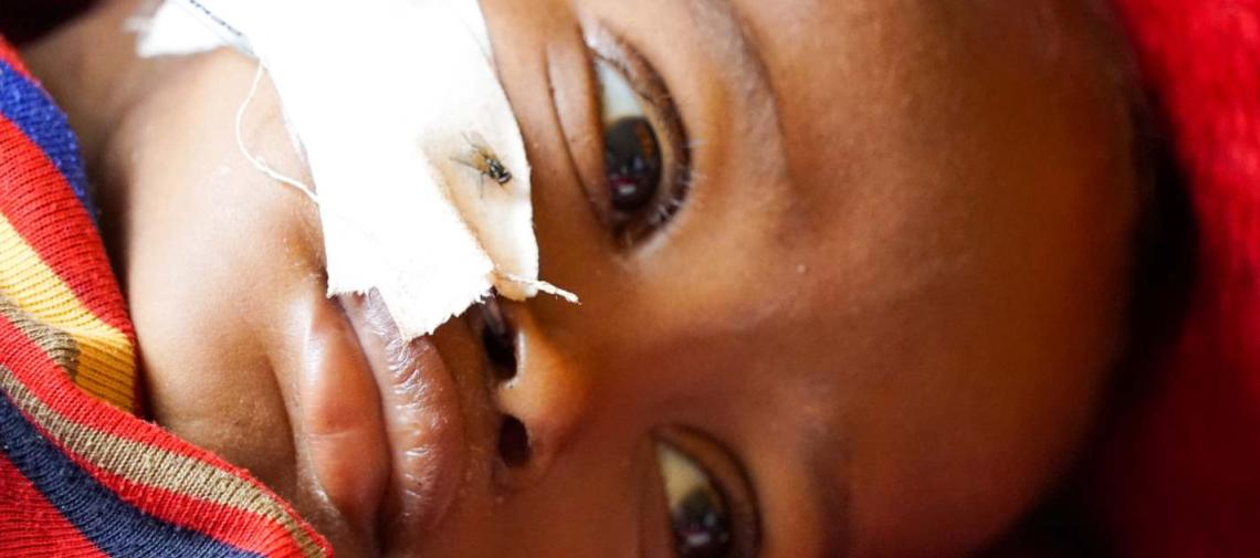 Krankes Kind in Somalia