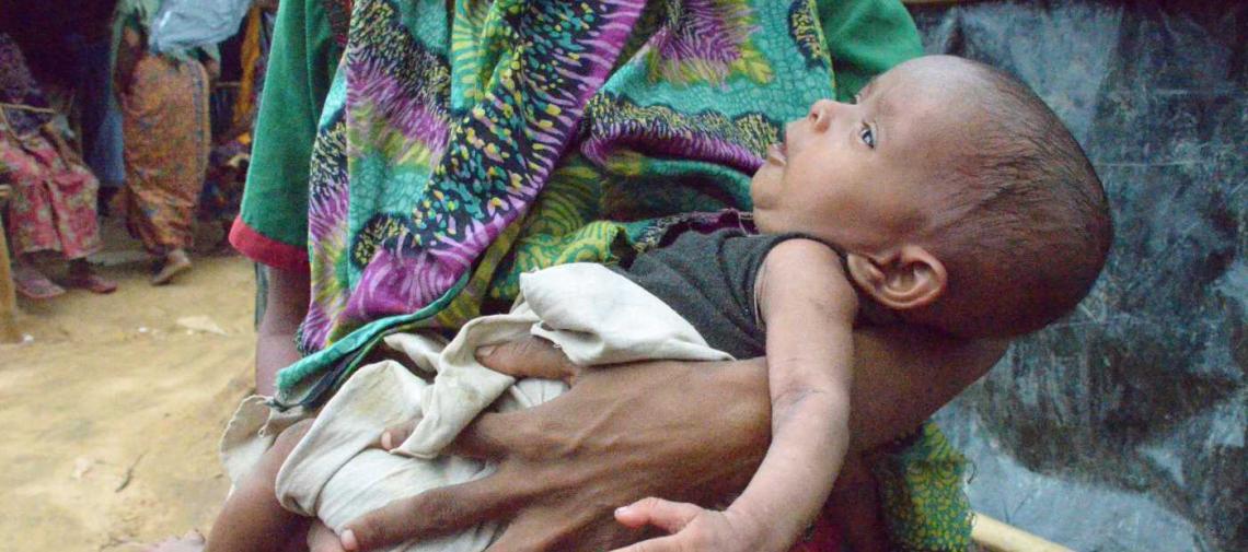 Geschwächtes Baby aus Myanmar im Flüchtlingslager in Bangladesch