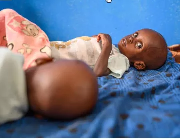 Flüchtlingskind aus Sudan