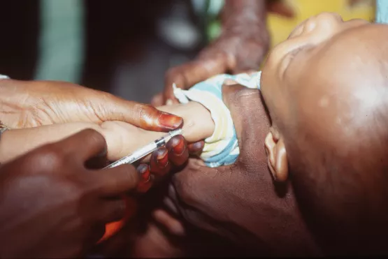 Die Impfung von Kindern gegen Krankheiten wie Polio wird durch die Covid-19-Pandemie vernachlässigt