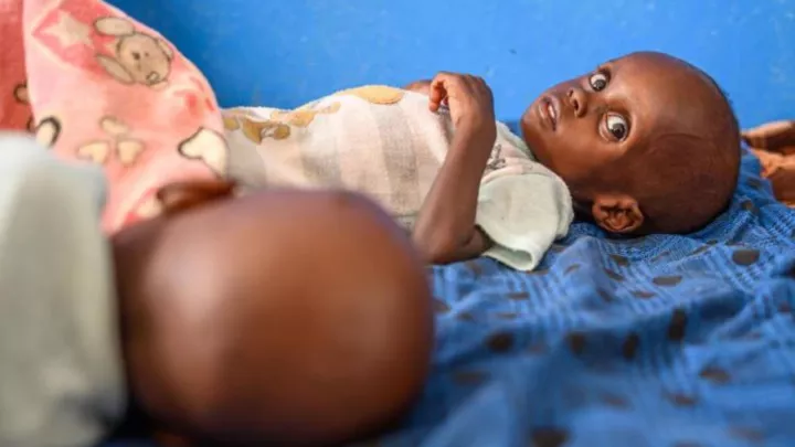 Unterernährung Sudankrise