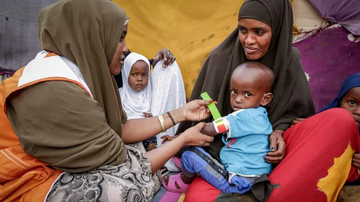 unterernährtes Kind wird untersucht