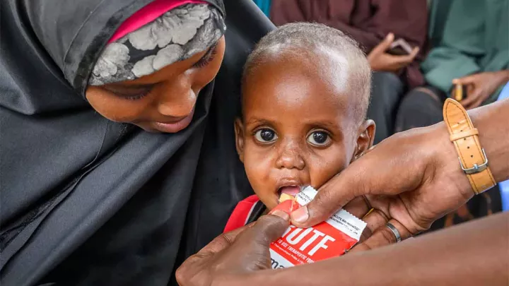 Unterernährtes Kind erhält Hilfe