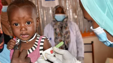 Afrikanisches Kind mit MUAC-Band