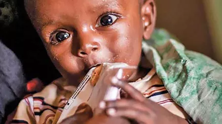 Hunger in Afrika: Mit 20 € Kindern Aufbaunahrung schenken