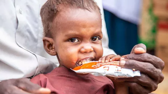 Unterernährtes Kind